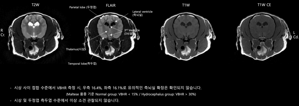 강아지 MRI 검사 결과 - 시상 및 두정엽, 측두엽